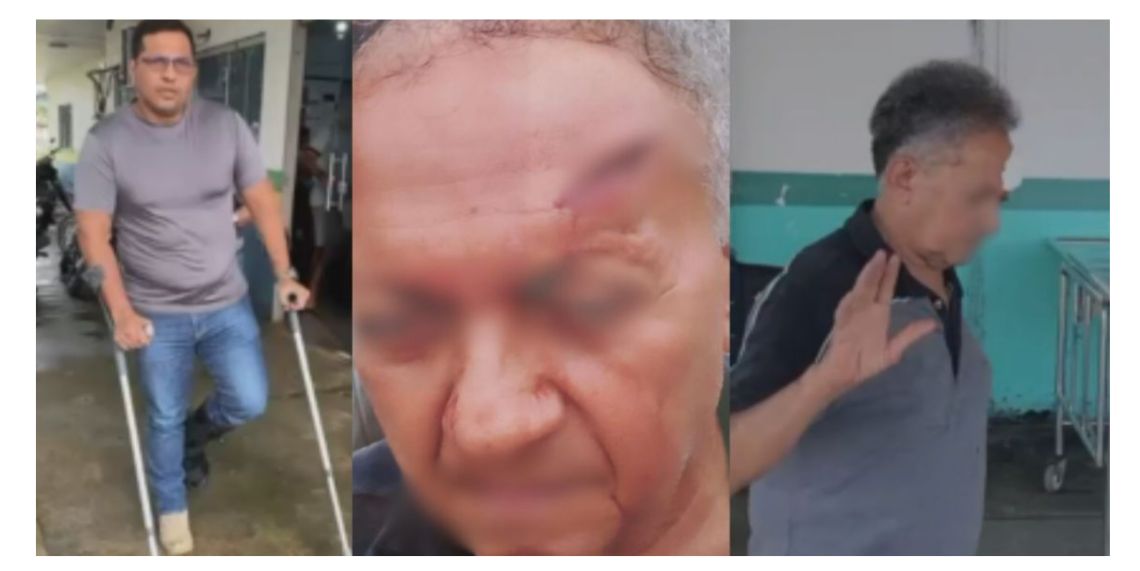 Idoso é agredido com golpe de muleta por PM que atua na unidade prisional de Itacoatiara